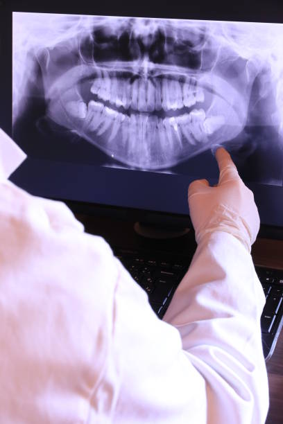 Best Emergency Treatment for Oral Infections in Ellisville, MS
